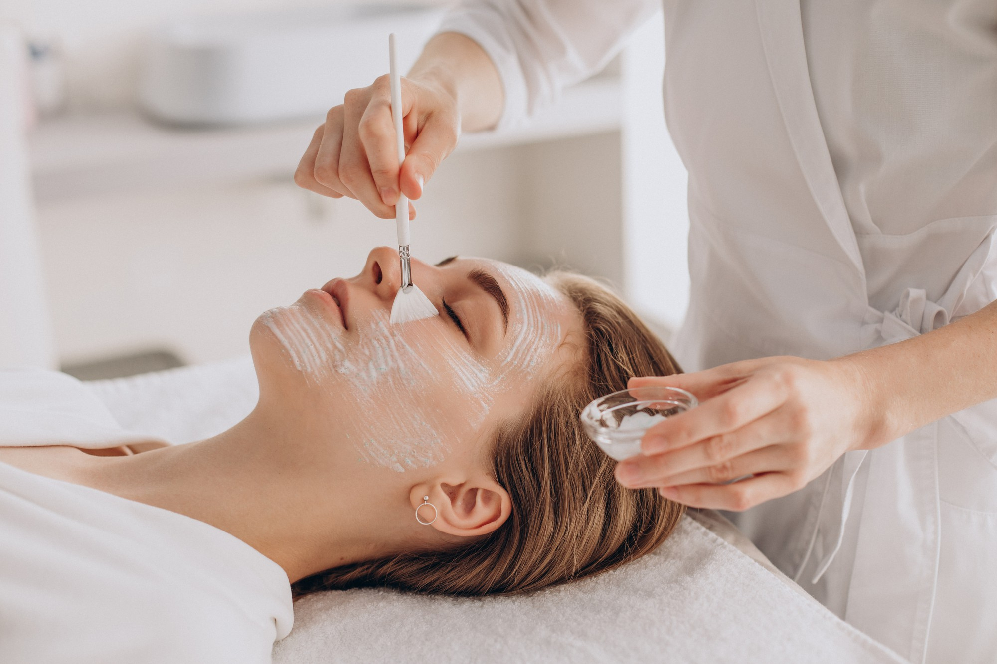 Chemical Peel