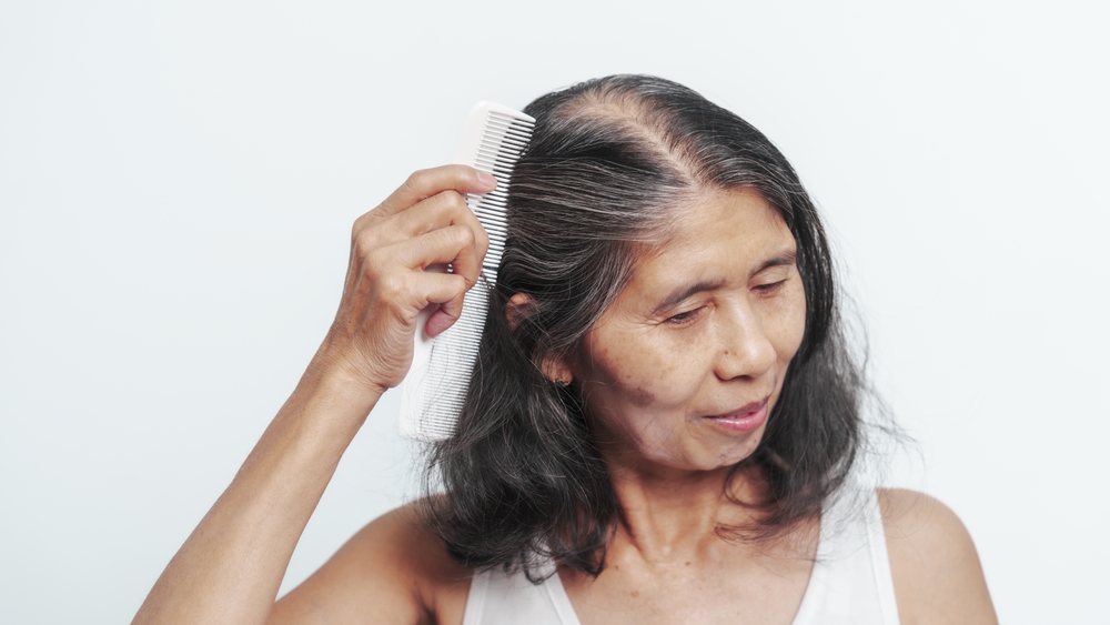 Hair Loss in Menopause: What Can You Do? 
