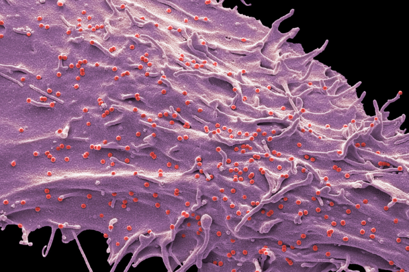 Unlocking the Potential of Exosomes A Comprehensive Guide